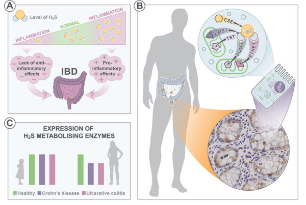 Graphical Abstract IBD+H2S