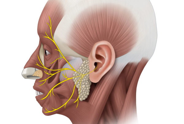 Facial Nerve