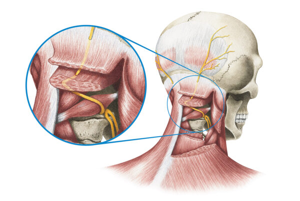 Greater Occipital Nerve