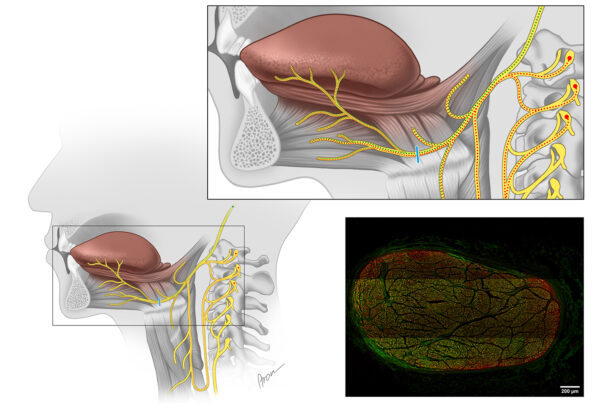 Axons of the Hypoglossal Nerve