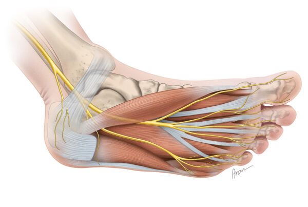 Plantar Nerve