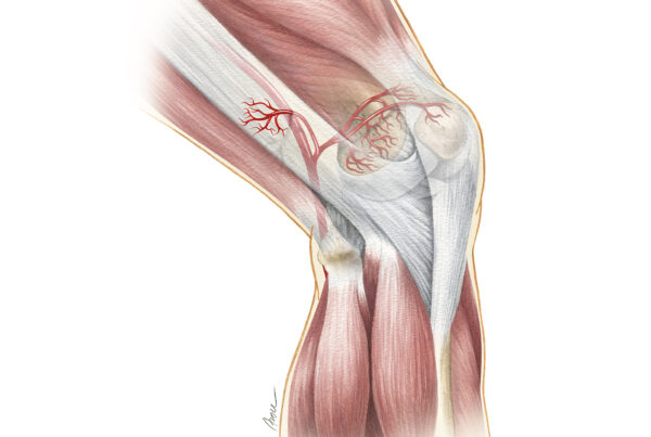 Superior Lateral Genicular Artery