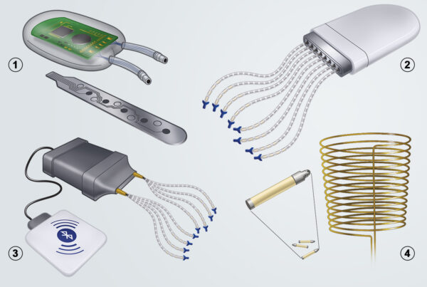EMG Electrode Implants