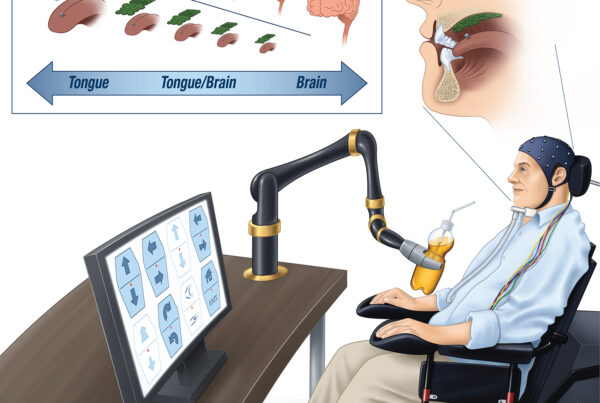 iTongue Robot Control